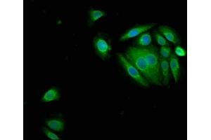 Immunofluorescence staining of A549 cells with ABIN7169337 at 1:150, counter-stained with DAPI. (SERPINB3 anticorps  (AA 2-383))