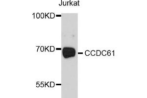Western blot analysis of extracts of Jurkat cells, using CCDC61 antibody (ABIN5997378) at 1/1000 dilution. (CCDC61 anticorps)
