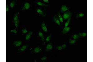 Immunofluorescence staining of Hela cells with ABIN7155342 at 1:133, counter-stained with DAPI. (UTY anticorps  (AA 1-72))