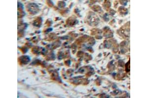 Used in DAB staining on fromalin fixed paraffin-embedded Pancreas tissue