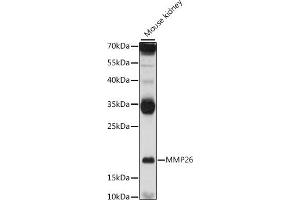 Western blot analysis of extracts of mouse kidney, using MMP26 antibody (ABIN7268423) at 1:1000 dilution. (MMP26 anticorps  (AA 90-261))