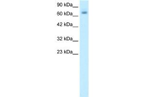 WB Suggested Anti-PAntibody Titration:  0. (PARP2 anticorps  (Middle Region))