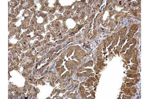 IHC-P Image Dishevelled 3 antibody [N1N2], N-term detects Dishevelled 3 protein at cytoplasm on mouse lung by immunohistochemical analysis.