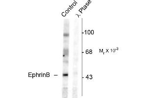 Western blots of rat testes lysate showing specific immunolabeling of the ~46k EphrinB phosphorylated at Tyr331 (Control). (EPH Receptor B2 anticorps  (pTyr331))