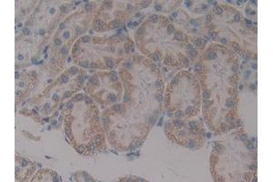 IHC-P analysis of Rat Kidney Tissue, with DAB staining. (Paxillin anticorps  (AA 327-568))
