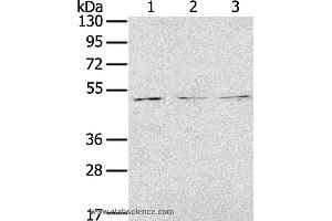 Western blot analysis of Jurkat, K562 and 293T cell, using FOXG1  Polyclonal Antibody at dilution of 1:200