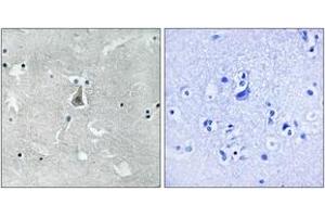 Immunohistochemistry analysis of paraffin-embedded human brain, using Bax (Phospho-Ser184) Antibody. (BAX anticorps  (pSer184))