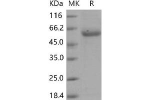 Western Blotting (WB) image for Alkaline Sphingomyelinase (Alk-Smase) protein (His tag) (ABIN7194215) (ENPP7 Protein (His tag))