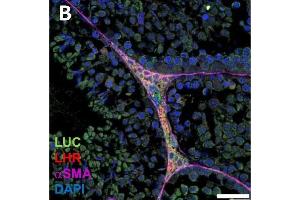 Luciferase expression in F1B-TMIR mouse testes.