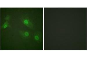 Immunofluorescence analysis of HeLa cells treated with EGF 200nM 5', using NF-kappaB p105/p50 (Phospho-Ser927) Antibody. (NFKB1 anticorps  (pSer927))