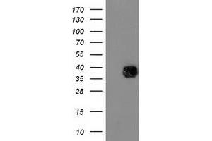 Western Blotting (WB) image for anti-NudE Nuclear Distribution E Homolog (A. Nidulans)-Like 1 (NDEL1) antibody (ABIN1499856) (NDEL1 anticorps)