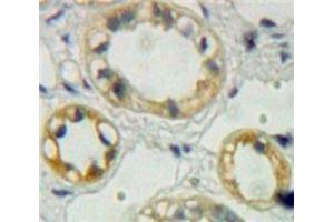 Used in DAB staining on fromalin fixed paraffin-embedded Kidney tissue