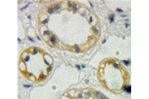 Used in DAB staining on fromalin fixed paraffin-embedded Kidney tissue (EPHA1 anticorps  (AA 716-960))