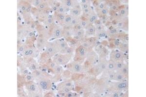 IHC-P analysis of Human Tissue, with DAB staining. (PPARD anticorps  (AA 260-426))