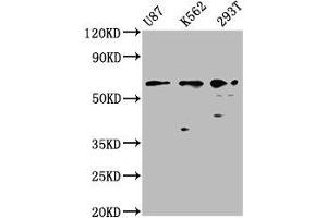 Western Blot Positive WB detected in: U87 whole cell lysate, K562 whole cell lysate, 293T whole cell lysate All lanes: ZNF37A antibody at 2. (ZNF37A anticorps  (AA 263-386))