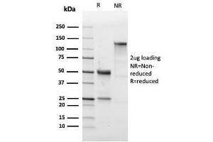 SDS-PAGE Analysis Purified CD43 Rabbit Recombinant Monoclonal Antibody (SPN/1766R).