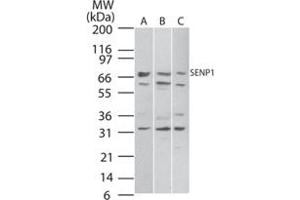Western blot analysis of SENP1 in A) Daudi, B) HeLa and C) NIH/3T3 cell lysate. (SENP1 anticorps  (AA 578-590))