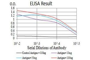 Black line: Control Antigen (100 ng),Purple line: Antigen (10 ng), Blue line: Antigen (50 ng), Red line:Antigen (100 ng)