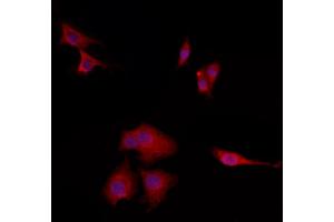 ABIN6265689 and ABIN6272867 staining HepG2 by IF/ICC.