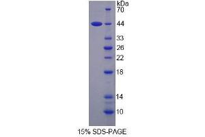 SDS-PAGE analysis of Human SMS Protein. (SMS Protéine)