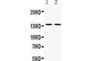 Western blot analysis of ABL2 expression in mouse brain extract ( Lane 1) and HELA whole cell lysates ( Lane 2). (ABL2 anticorps  (AA 1065-1182))