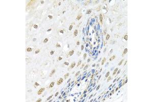Immunohistochemistry of paraffin-embedded human esophagus using ELAC2 antibody (ABIN5974286) at dilution of 1/100 (40x lens). (ELAC2 anticorps)