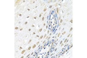 Immunohistochemistry of paraffin-embedded human esophagus using ELAC2 antibody (ABIN5974286) at dilution of 1/100 (40x lens). (ELAC2 anticorps)