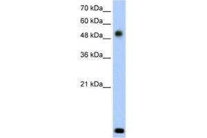 Western Blotting (WB) image for anti-Radical S-Adenosyl Methionine Domain Containing 2 (RSAD2) antibody (ABIN2462622) (RSAD2 anticorps)