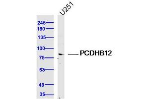 U251 lysates probed with PCDHB12 Polyclonal Antibody, Unconjugated  at 1:300 dilution and 4˚C overnight incubation. (PCDHB12 anticorps  (AA 121-220))