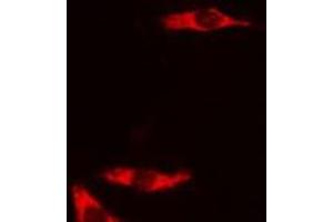 ABIN6278588 staining COLO205 cells by IF/ICC. (GAL4 anticorps  (N-Term))