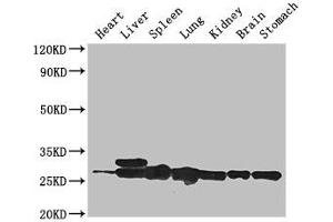 Western Blot Positive WB detected in: Mouse heart tissue, Mouse liver tissue, Mouse spleen tissue, Mouse lung tissue, Mouse kidney tissue, Mouse brain tissue, Mouse stomach tissue All lanes: SWI5 antibody at 3 μg/mL Secondary Goat polyclonal to rabbit IgG at 1/50000 dilution Predicted band size: 27 kDa Observed band size: 27, 29 kDa (SWI5 anticorps  (AA 54-112))