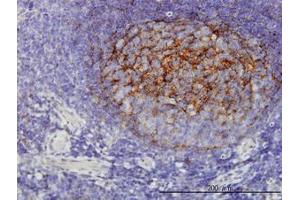 Image no. 1 for anti-Quinolinate Phosphoribosyltransferase (QPRT) (AA 198-298) antibody (ABIN599197) (QPRT anticorps  (AA 198-298))