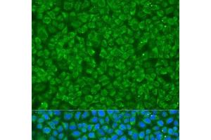 Immunofluorescence analysis of U2OS cells using GOSR1 Polyclonal Antibody at dilution of 1:100. (GS28 anticorps)