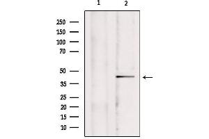 Western blot analysis of extracts from mouse brain, using CCDC109A Antibody. (MCU anticorps  (Internal Region))