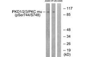 Western blot analysis of extracts from A549 cells treated with PMA 125ng/ml 30' and HT29 cells treated with serum 20% 15', using PKD1/2/3/PKC mu (Phospho-Ser738+Ser742) Antibody. (PKD1/2/3/PKC mu (AA 706-755), (pSer738) anticorps)