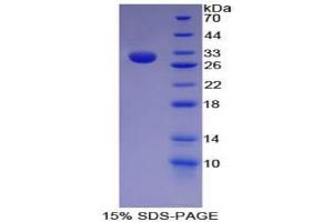 SDS-PAGE analysis of Mouse HAT1 Protein. (HAT1 Protéine)