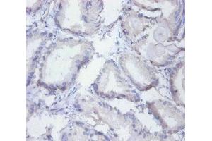 Immunohistochemistry of paraffin-embedded human prostate tissue using ABIN7155134 at dilution of 1:100