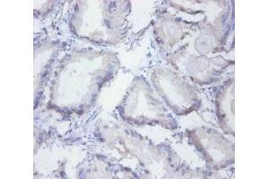 Immunohistochemistry of paraffin-embedded human prostate tissue using ABIN7155134 at dilution of 1:100 (SYNCRIP anticorps  (AA 2-191))