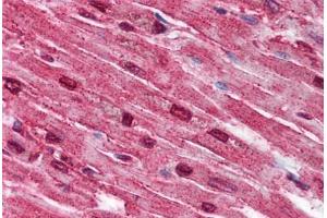 Human Heart (formalin-fixed, paraffin-embedded) stained with SPTLC2 antibody ABIN790286 at 5 µg/ml followed by biotinylated goat anti-rabbit IgG secondary antibody ABIN481713, alkaline phosphatase-streptavidin and chromogen.