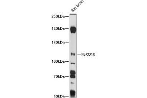 Western blot analysis of extracts of rat brain, using FBXO10 antibody (ABIN7267084) at 1:1000 dilution. (FBXO10 anticorps  (AA 1-180))