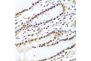 Immunohistochemistry of paraffin-embedded human stomach using METTL3 antibody at dilution of 1:100 (40x lens). (METTL3 anticorps)