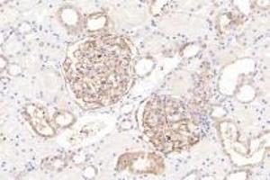 Immunohistochemistry analysis of paraffin-embedded human kidney using Integrin alpha V (ABIN7074314) at dilution of 1: 1000