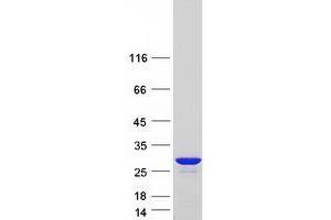 Validation with Western Blot