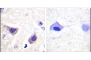 Immunohistochemistry analysis of paraffin-embedded human brain tissue, using JAK3 (Ab-785) Antibody. (JAK3 anticorps  (AA 751-800))