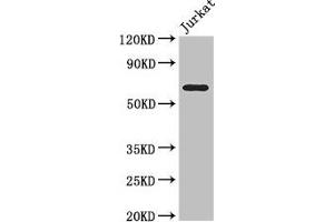 Western Blot Positive WB detected in: Jurkat whole cell lysate All lanes: SLC38A9 antibody at 3. (SLC38A9 anticorps  (AA 1-119))