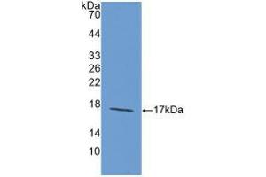 Figure. (Laminin alpha 1 anticorps  (AA 1156-1276))
