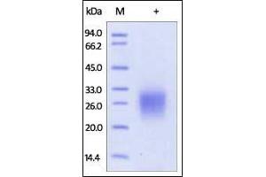 Human CD74, His Tag on SDS-PAGE under reducing (R) condition. (CD74 Protein (AA 73-232) (His tag))
