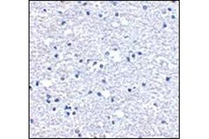 Immunohistochemistry of PD-1 in human brain tissue with this product at 5 μg/ml.