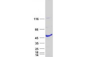 Validation with Western Blot