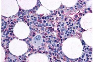 Anti-F2RL3 / PAR4 antibody  ABIN1048594 IHC staining of human bone marrow. (F2RL3 anticorps  (Cytoplasmic Domain))